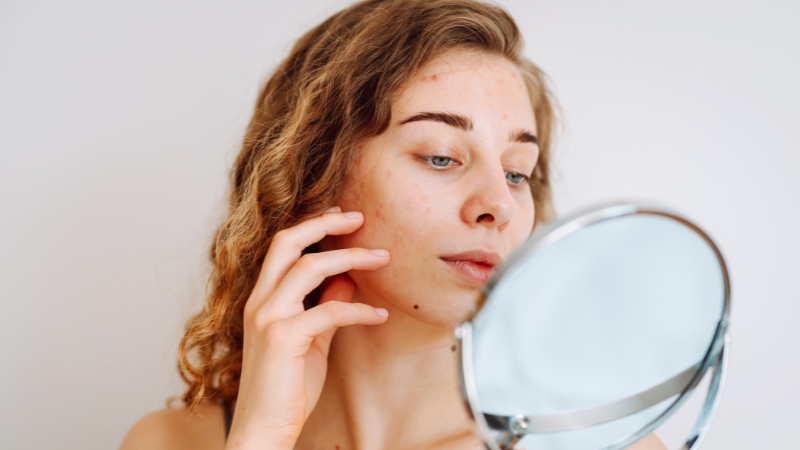 Tinejdžerka sa problematičnom kožom se gleda u ogledalo